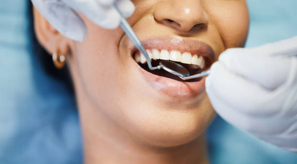 Best Chipped Tooth Repair Near Me  in Conshohocken, PA